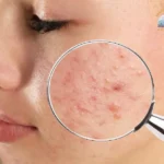 Esthetician performing a professional skin analysis during a client consultation (2)