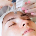 Master Esthetics instructor demonstrating micro-needling device technique to student